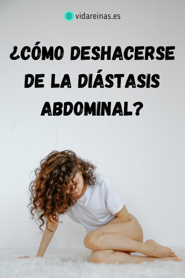 Cómo deshacerse de la diástasis abdominal Vida Reinas