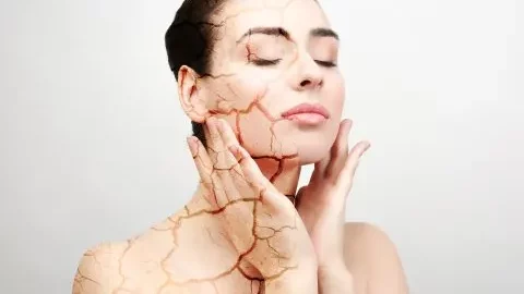 ¿Cómo combatir la sequedad de la piel del rostro? Aquí hay 7 recetas milagrosas