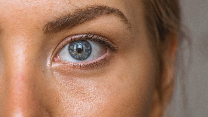 Ojeras: ¿cómo eliminar las ojeras y las arrugas?